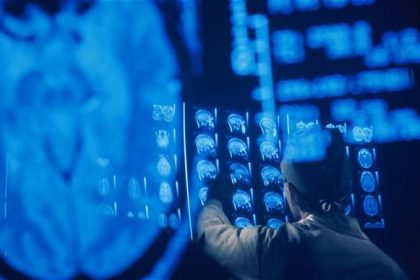 MRI_scan_2938831b-large_transpJliwavx4coWFCaEkEsb3kvxIt-lGGWCWqwLa_RXJU8 فراموشی خواب