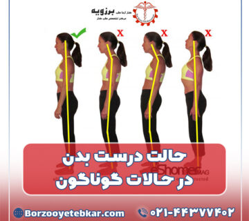 حالت درست بدن در حالات گوناگون