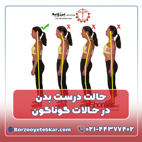 حالت درست بدن در حالات گوناگون