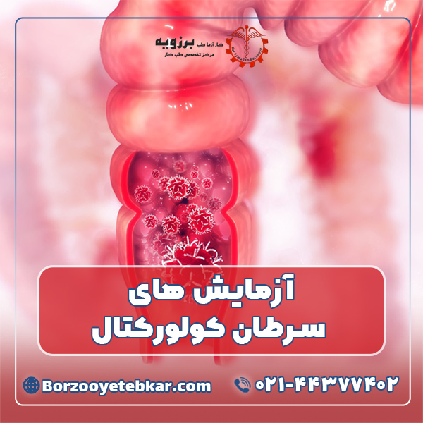 آزمایش های سرطان کولورکتال