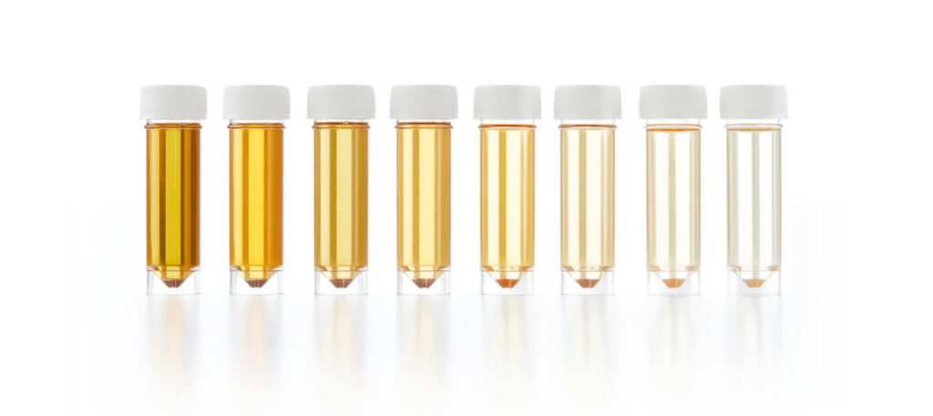 تغییر رنگ ادرار نشانه چیست؟