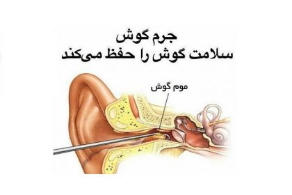 گوش جرم گوش