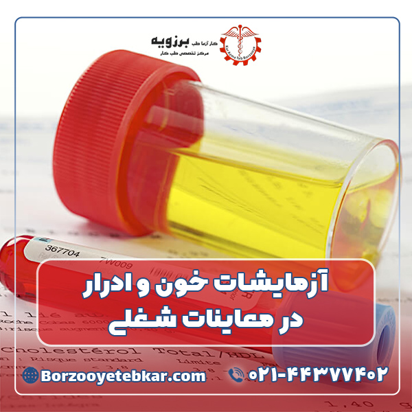 آزمایشات خون و ادرار در معاینات شغلی