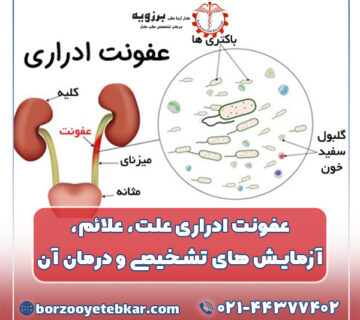 آزمایش عفونت ادراری