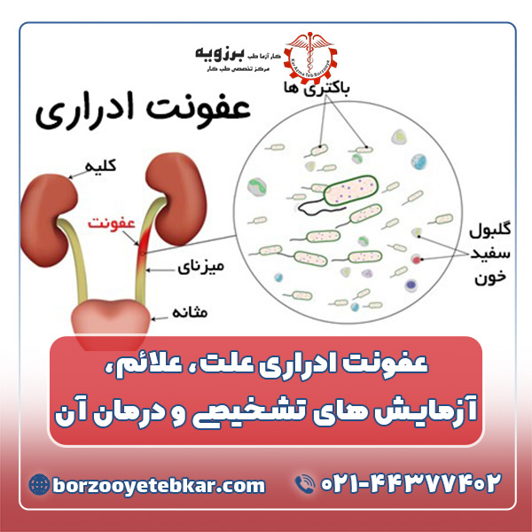 آزمایش عفونت ادراری