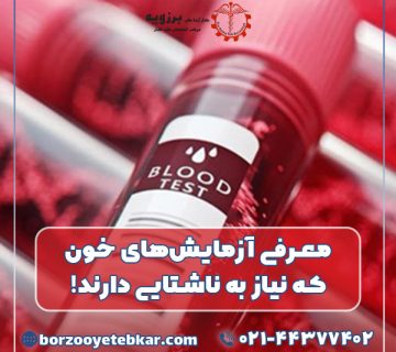 معرفی آزمایش‌های خون که نیاز به ناشتایی دارند!