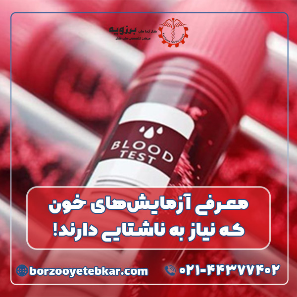 معرفی آزمایش‌های خون که نیاز به ناشتایی دارند!