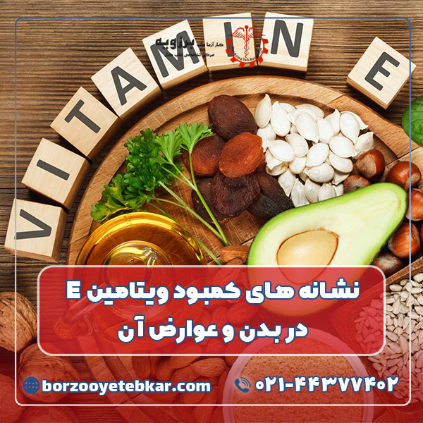 نشانه های کمبود ویتامین E در بدن و عوارض آن