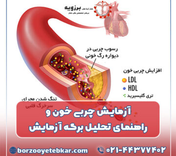آزمایش چربی خون و راهنمای تحلیل برگه آزمایش