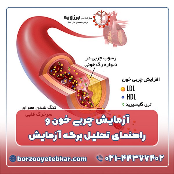 آزمایش چربی خون و راهنمای تحلیل برگه آزمایش