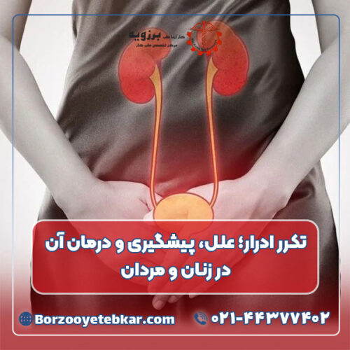 تکرر ادرار؛ علل، پیشگیری و درمان آن در زنان و مردان تکرر ادرار؛ علل، پیشگیری و درمان آن در زنان و مردان